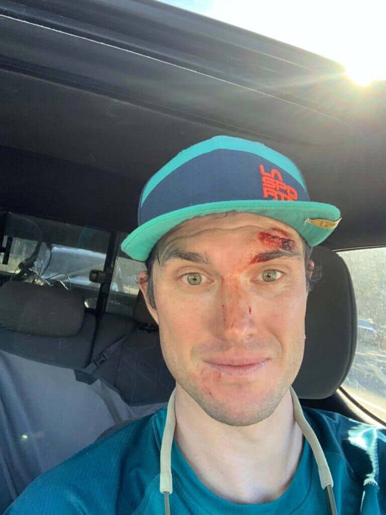 Man sitting in car wearing hat with bloody left eyebrow from mountain bike crash